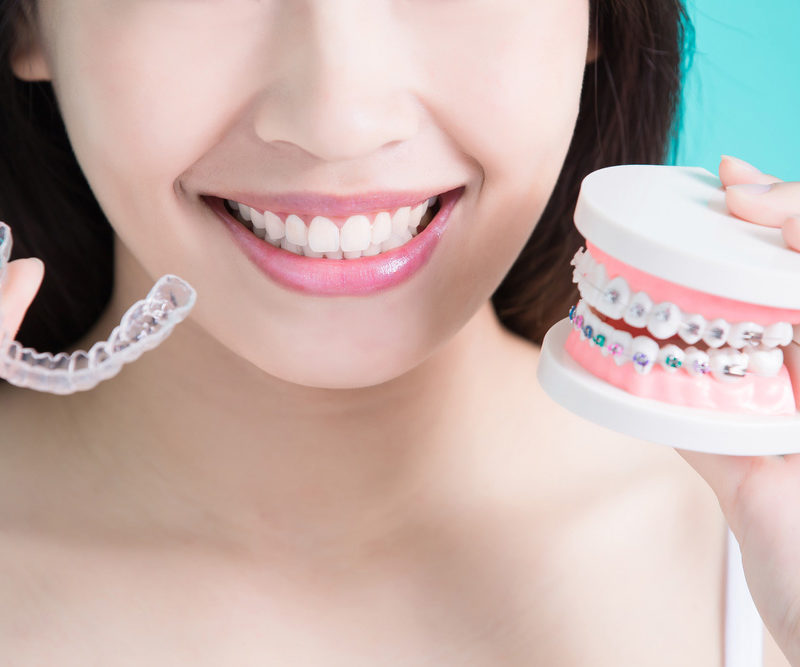 Cost of Braces