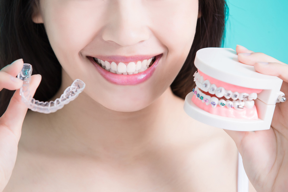 Cost of Braces
