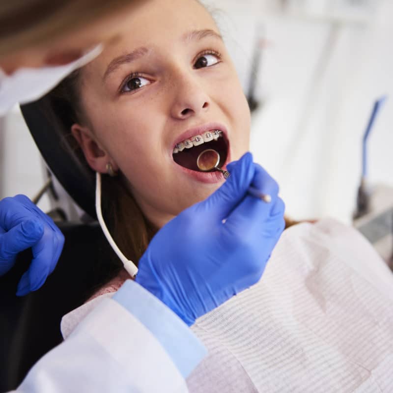 what is a crossbite