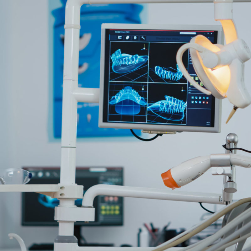 Our Laser Sintered Bands Eliminate the Need for Orthodontic Spacers